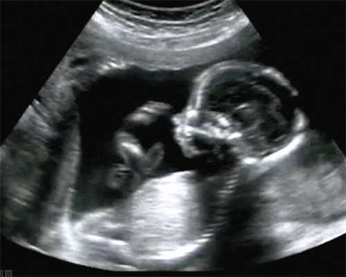济南医院代孕资质,天津试管婴儿二胎放几个胚胎哪些人适合放2个胚胎_卵巢早衰